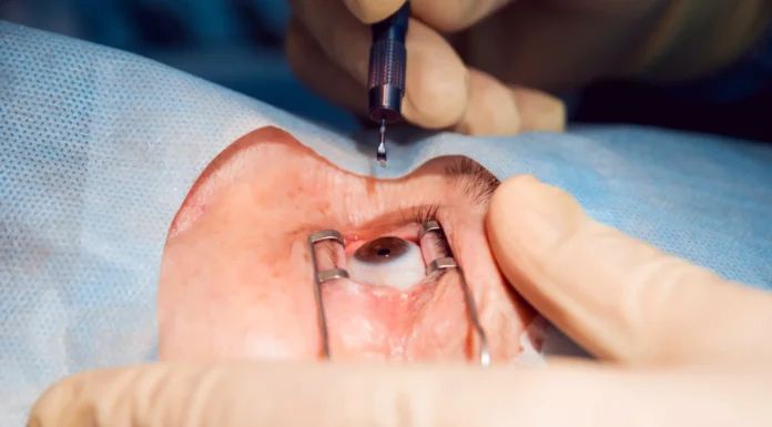 Chirurgie réfractive avec le Dr Chantal Bensoussan Chirurgie réfractive Dr Chantal Bensoussan