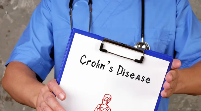 Maladie de Crohn : espérance de vie maladie de Crohn