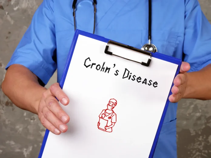 maladie de Crohn