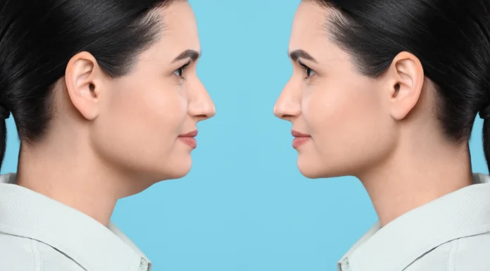 Dr Olivier Gerbault : l’expert en rhinoplastie ultrasonique Dr Olivier Gerbault