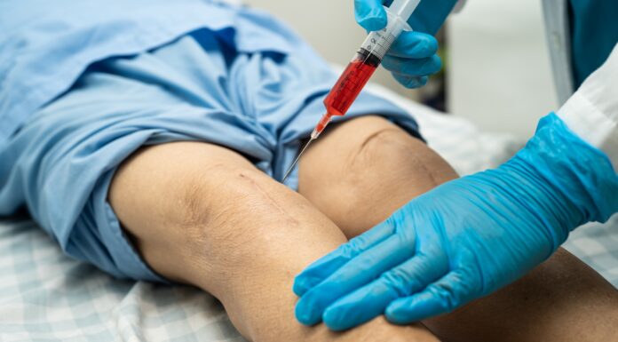 Infiltration genou : tout comprendre sur cette procédure médicale ! Infiltration genou